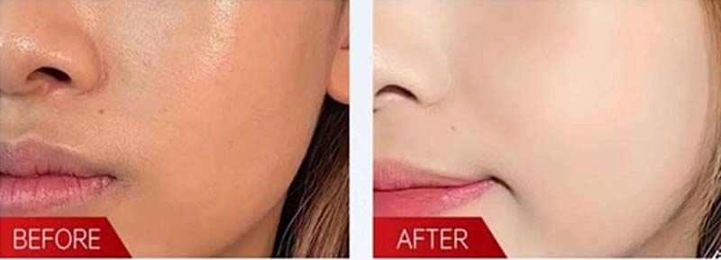 Whitening and Moisturizing Lotion